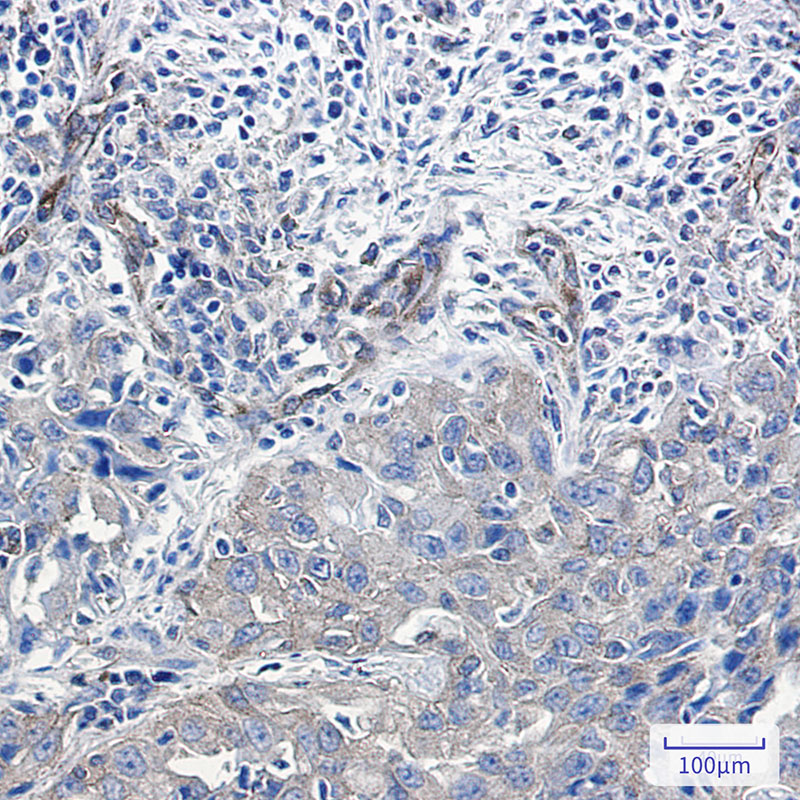 Rabbit Monoclonal Antibody to NUMB