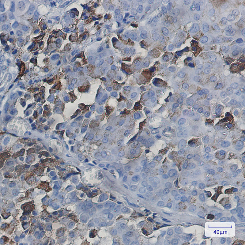 Rabbit Monoclonal Antibody to NXF1