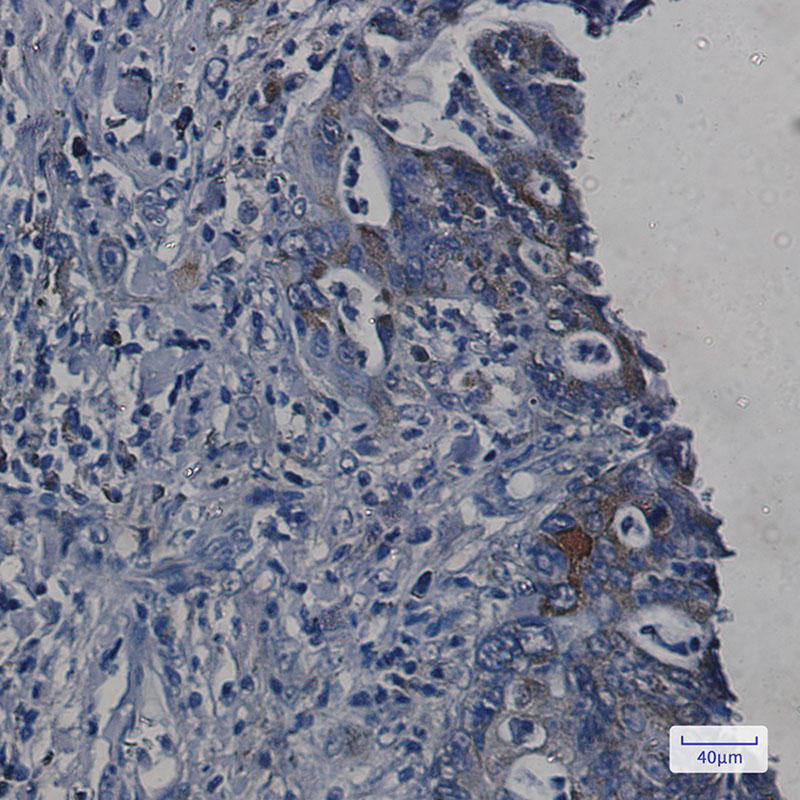 Rabbit Monoclonal Antibody to ORP150