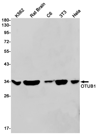 OTUB1