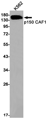 p150 CAF1