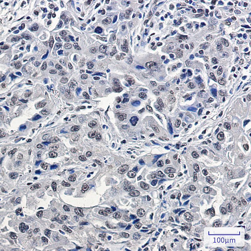 Rabbit Monoclonal Antibody to p150 CAF1
