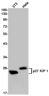 p27 Kip 1
