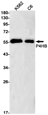P4HB
