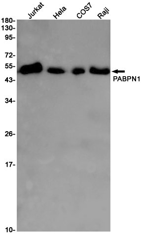 PABPN1
