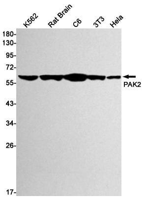 PAK2