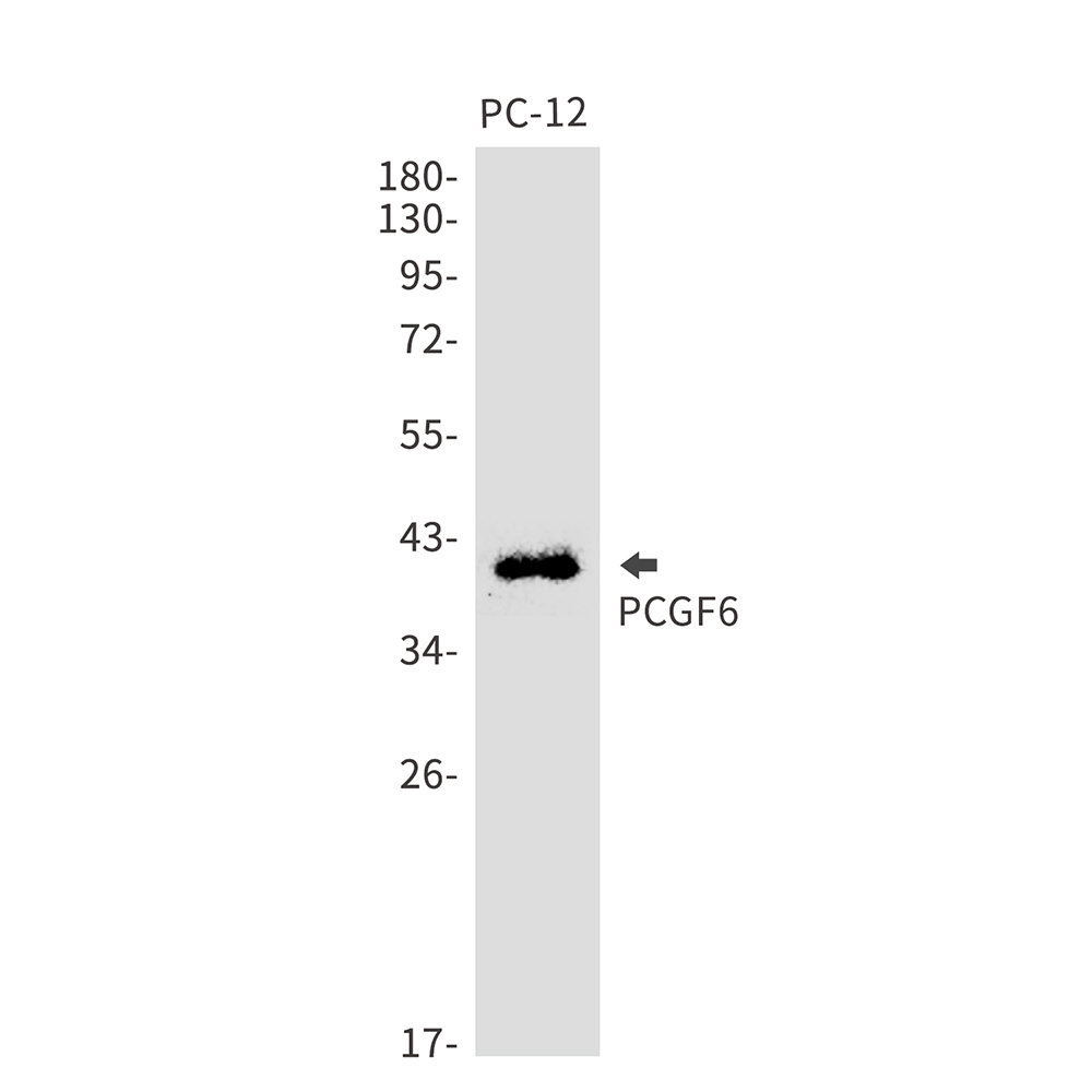 PCGF6