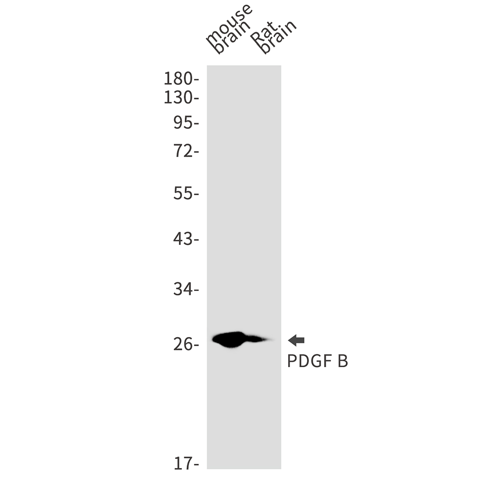 PDGF B