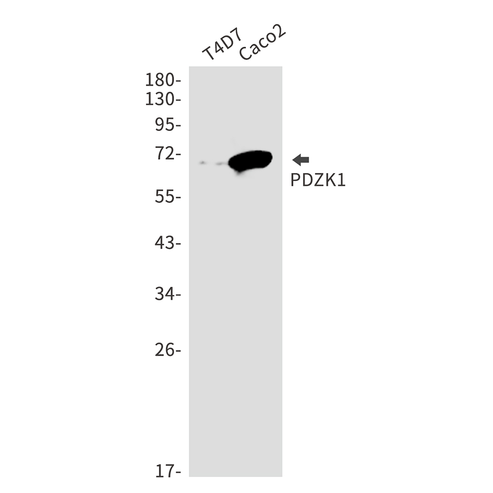 PDZK1