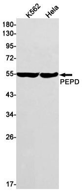 PEPD