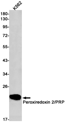 Peroxiredoxin 2