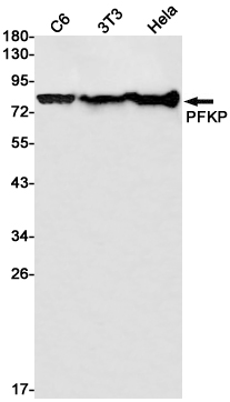 PFKP
