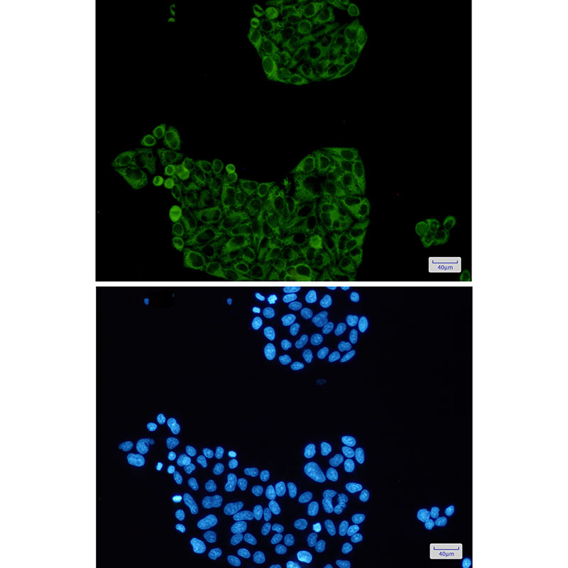 Rabbit Monoclonal Antibody to PFKP