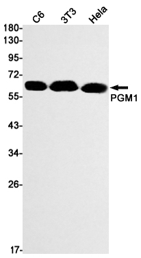 PGM1