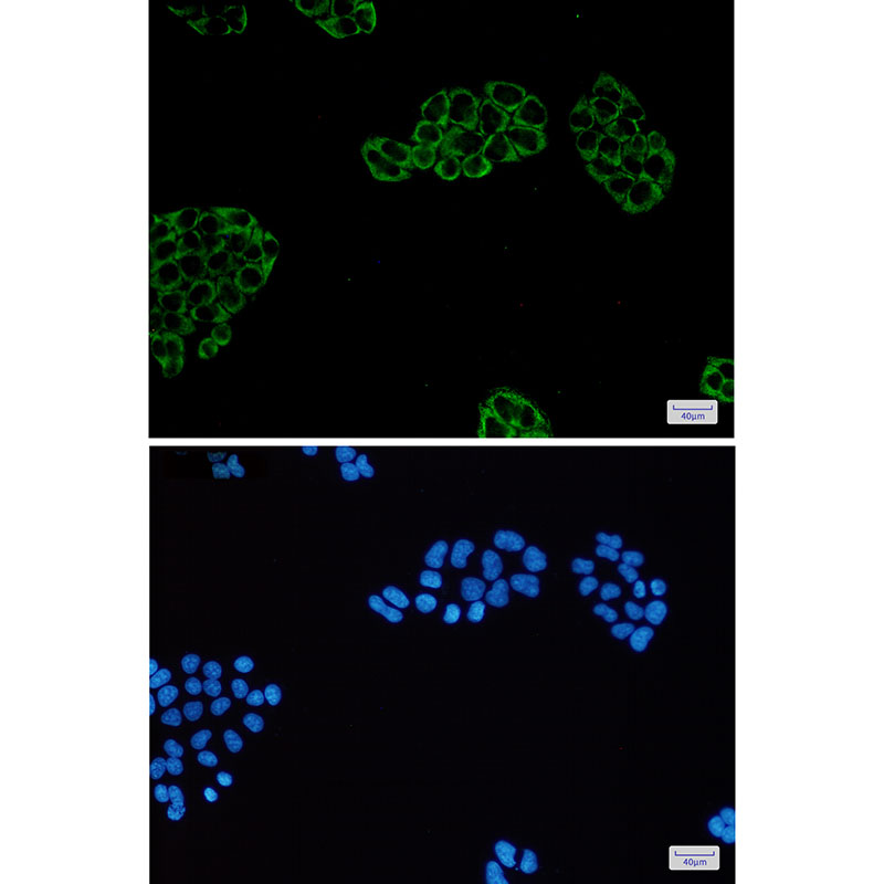 Rabbit Monoclonal Antibody to PGM1