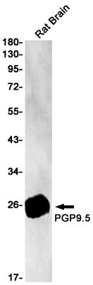 Rabbit Monoclonal Antibody to PGP9.5