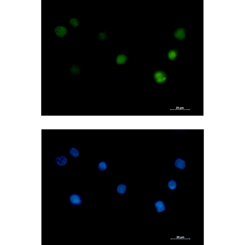 Rabbit Monoclonal Antibody to PHAPI2