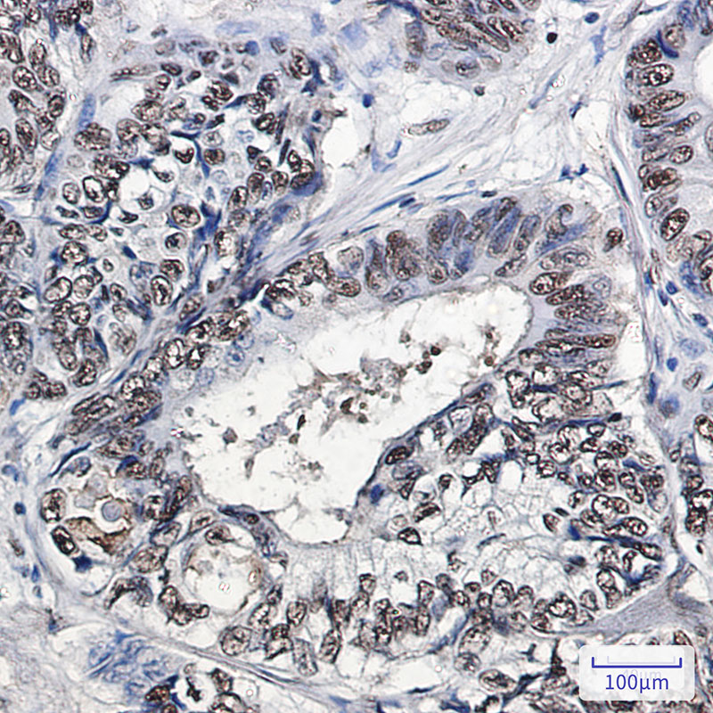 Rabbit Monoclonal Antibody to PHAPI2