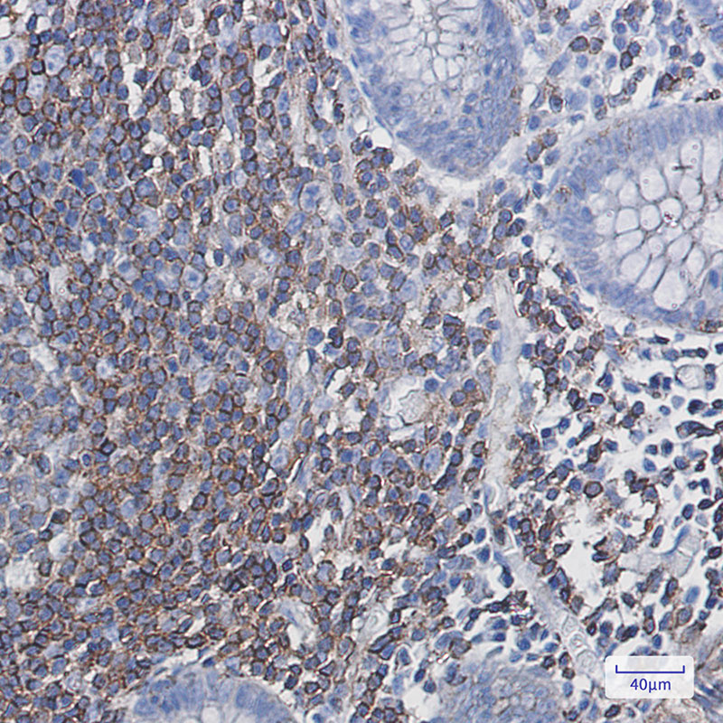 Rabbit Monoclonal Antibody to PHD3