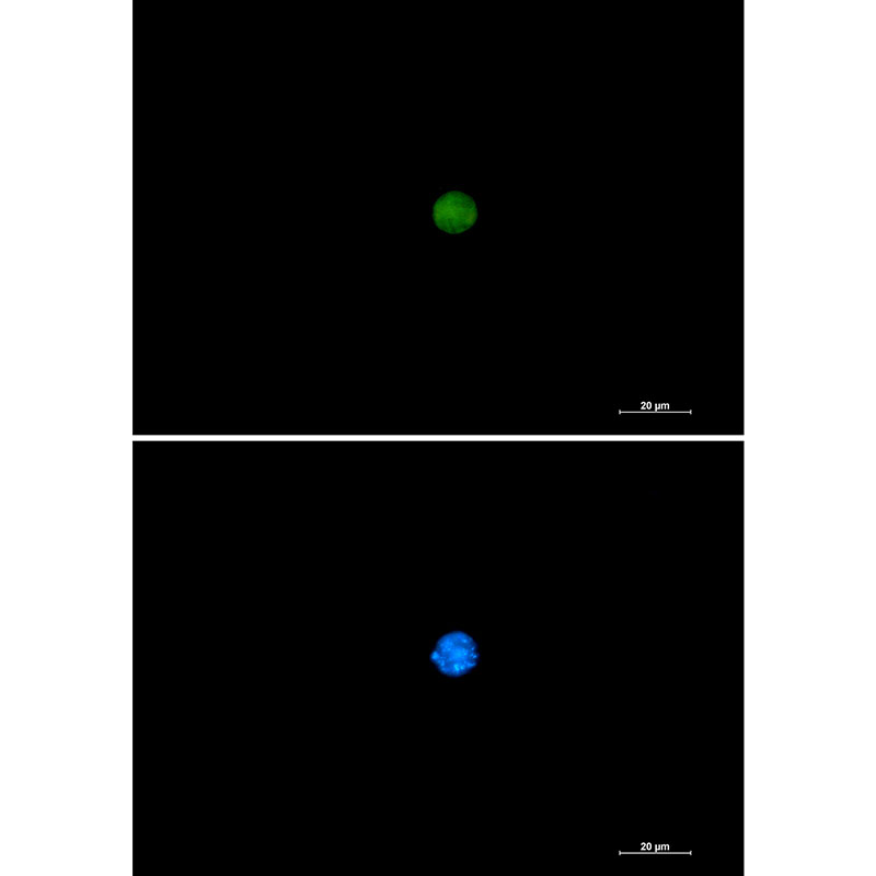 Rabbit Monoclonal Antibody to PIN1