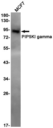 Rabbit Monoclonal Antibody to PIP5K1C