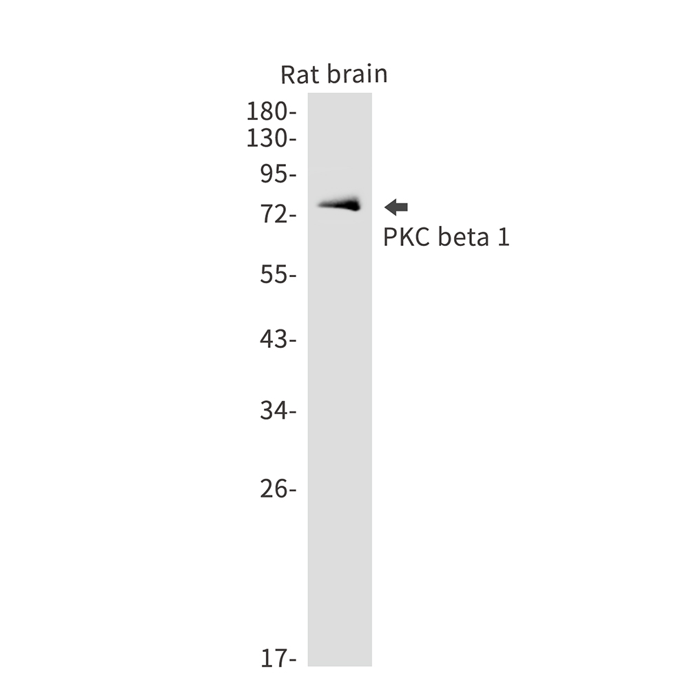 PKC beta 1