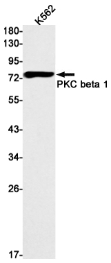 Rabbit Monoclonal Antibody to PKC beta 1