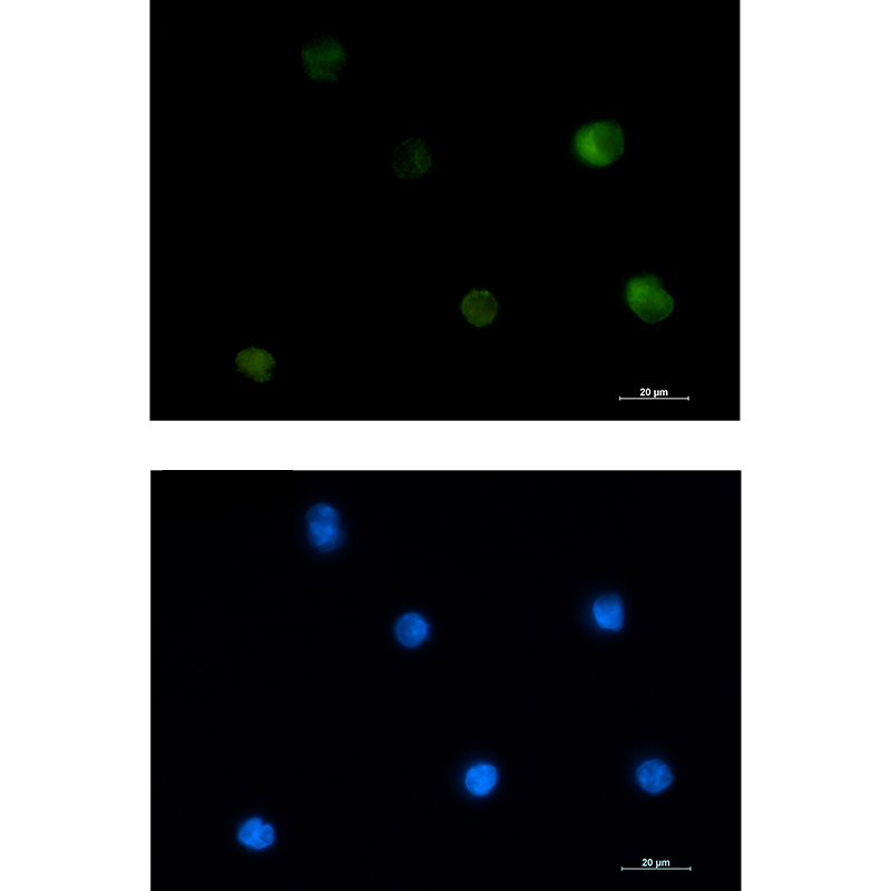 Rabbit Monoclonal Antibody to PKC beta 1