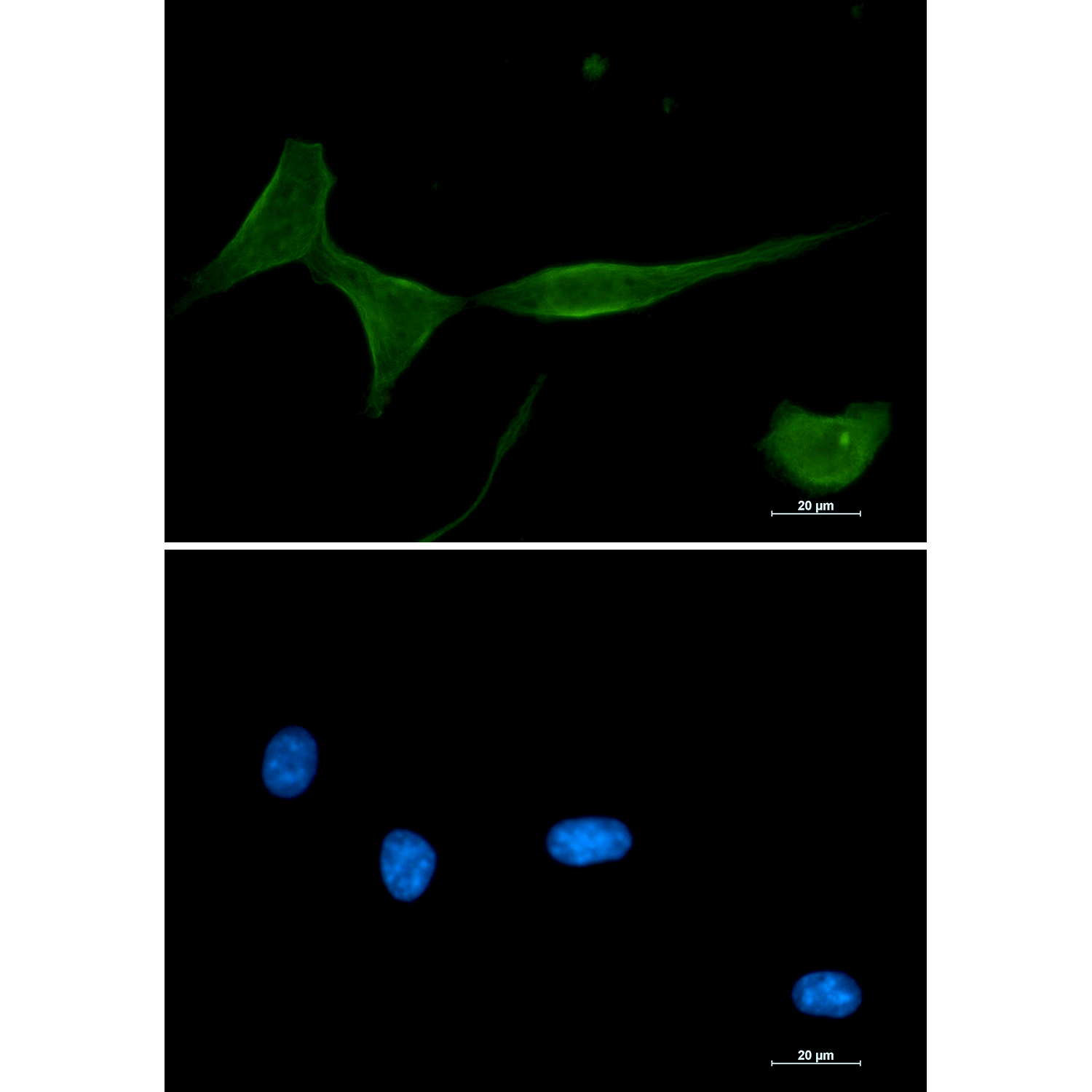 Rabbit Monoclonal Antibody to PKC delta