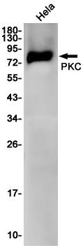 Rabbit Monoclonal Antibody to PKC gamma