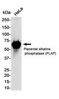 Placental Alkaline Phosphatase