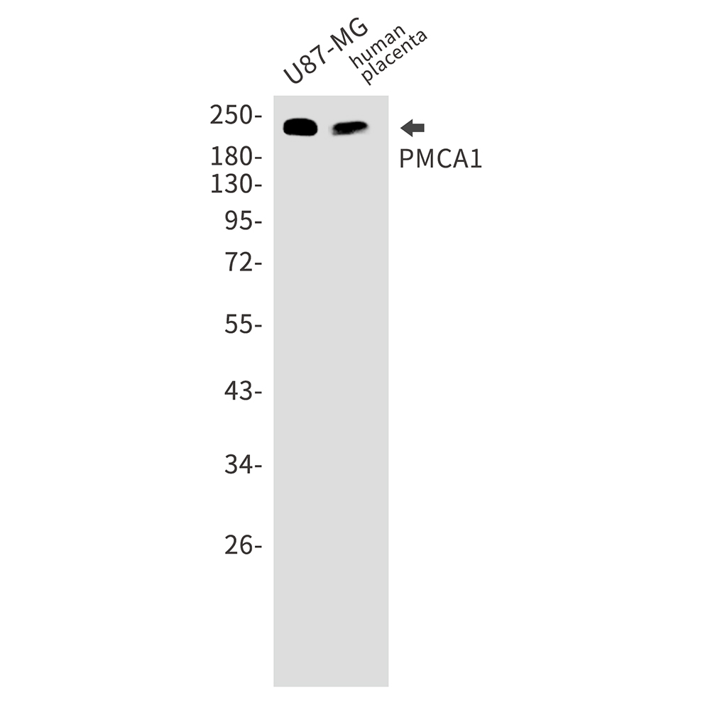 Rabbit Monoclonal Antibody to PMCA1