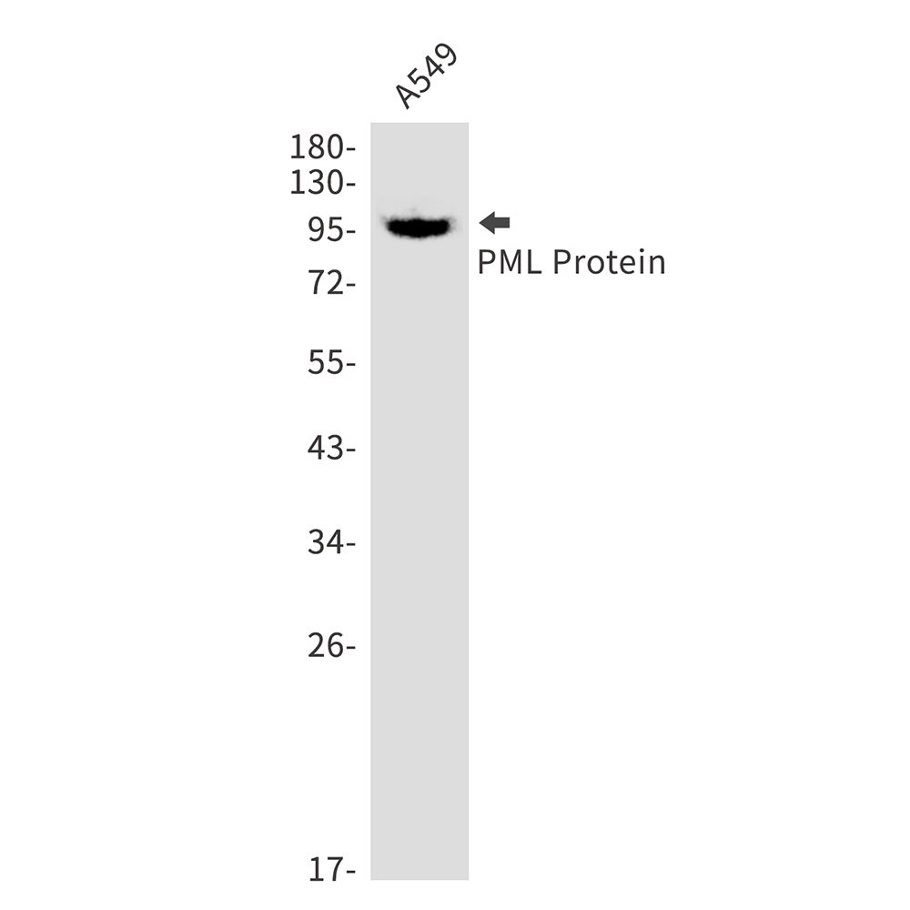 PML Protein