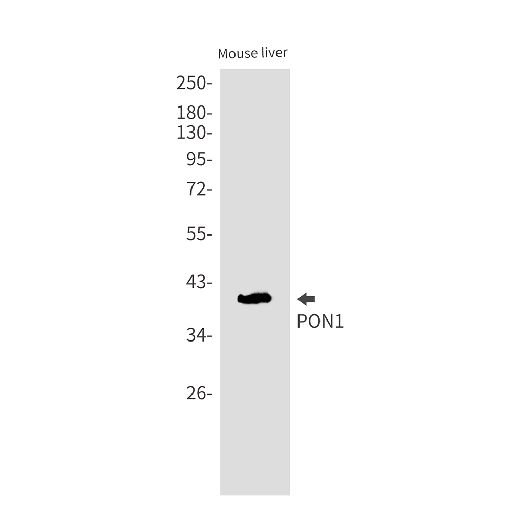 PON1