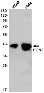 PON2