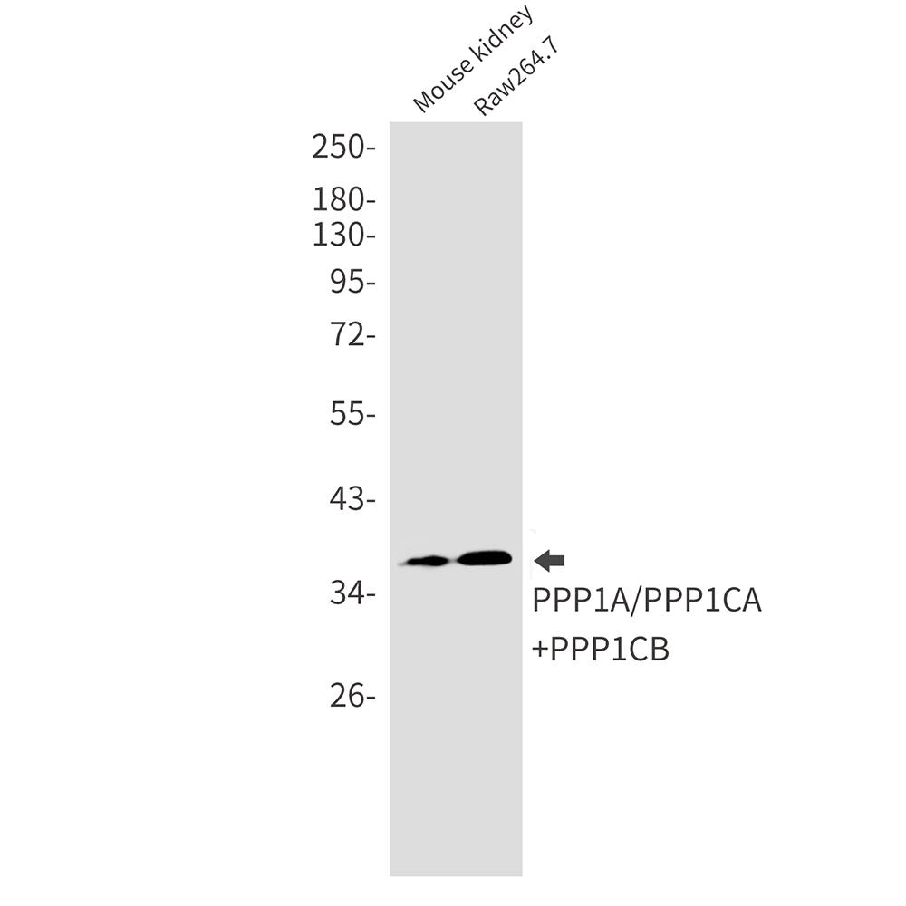 PP1C alpha/beta