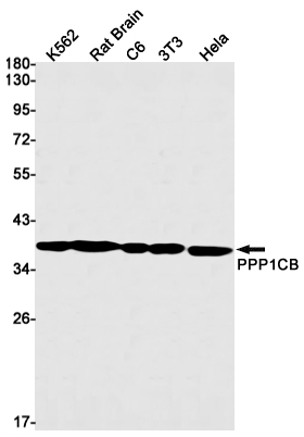 PP1C beta