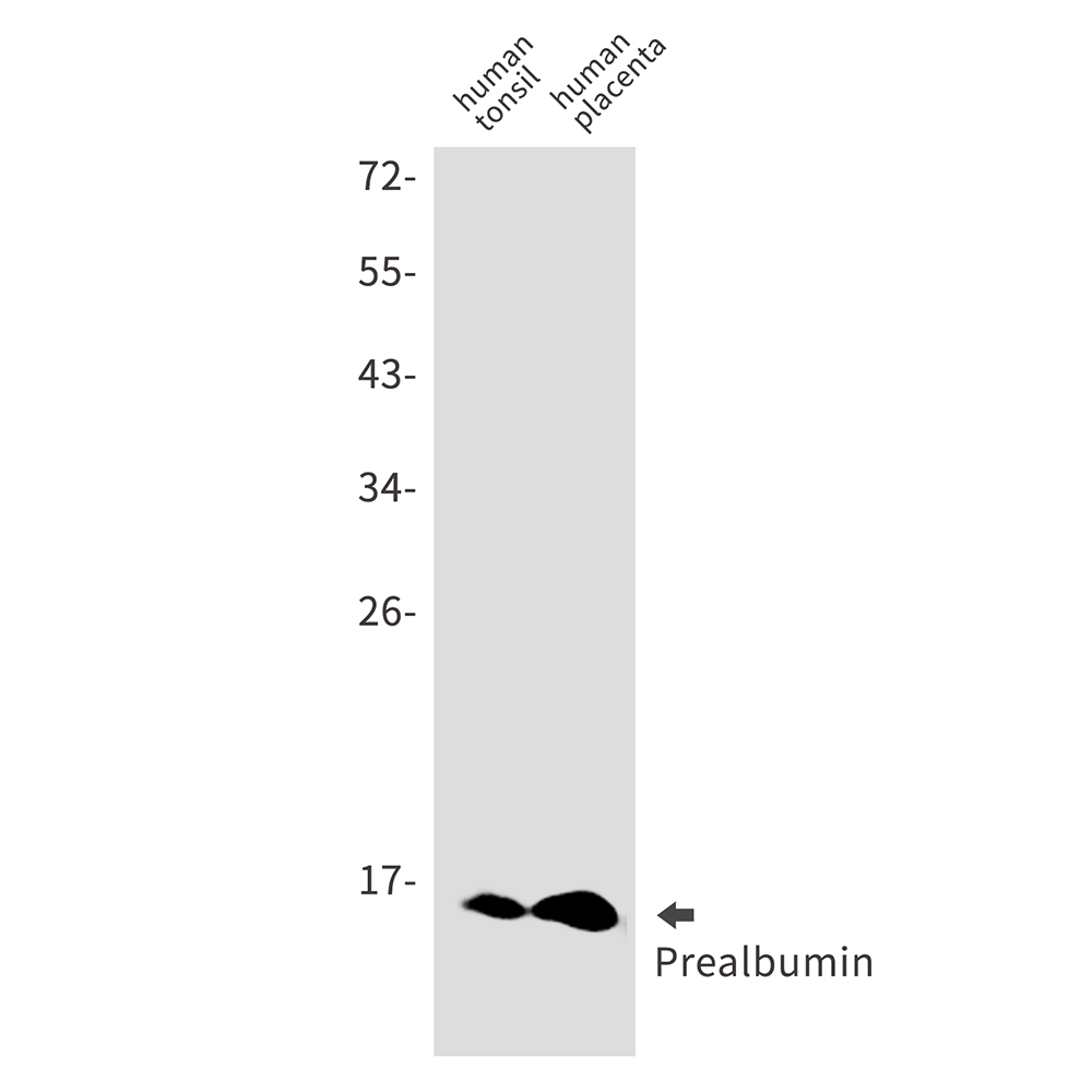 Prealbumin