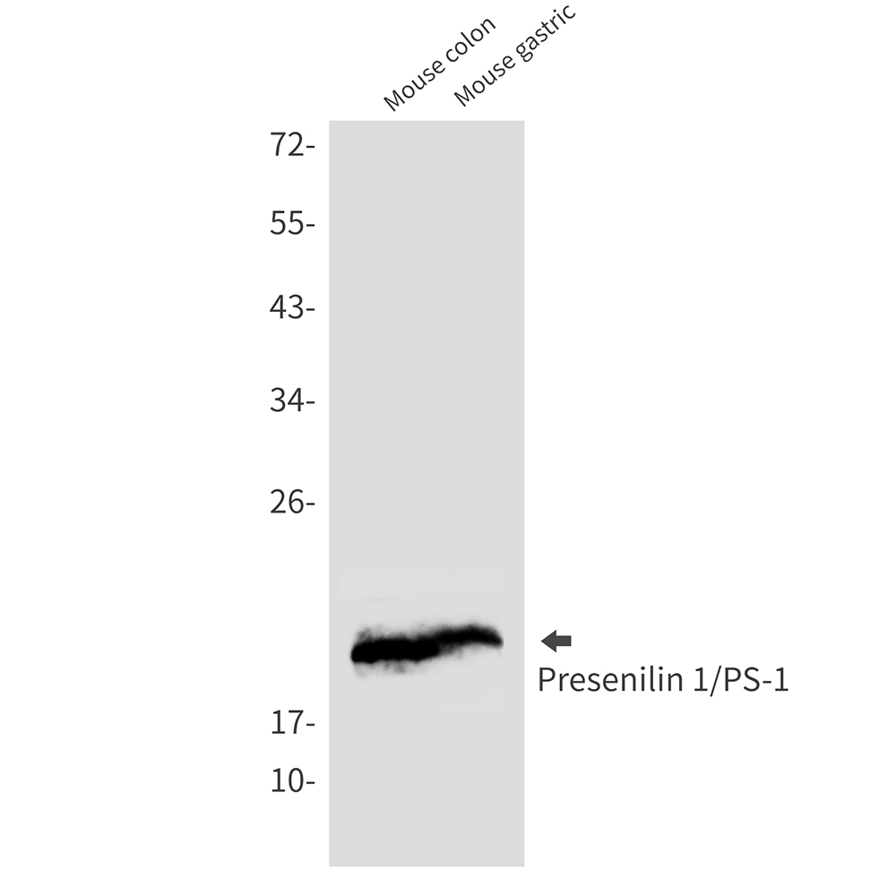 Presenilin 1
