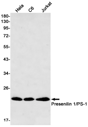 Rabbit Monoclonal Antibody to Presenilin 1
