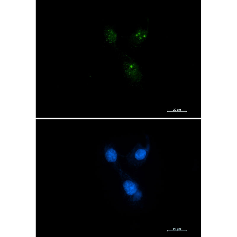 Rabbit Monoclonal Antibody to Presenilin 1