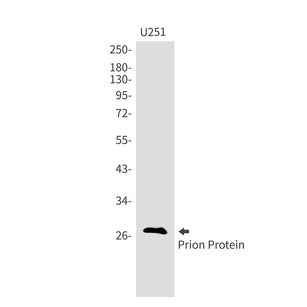 Prion Protein