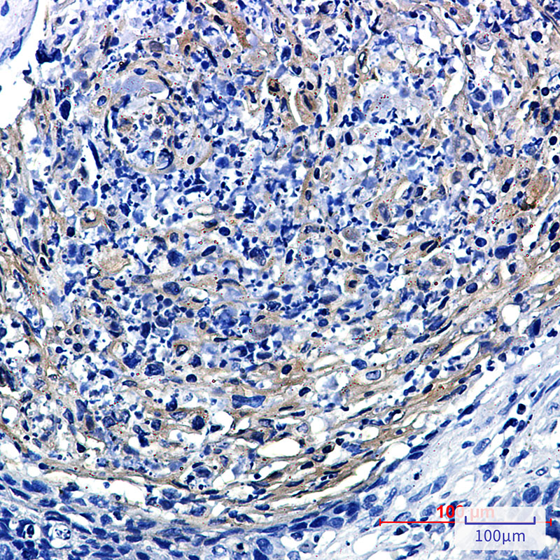 Rabbit Monoclonal Antibody to PRMT3