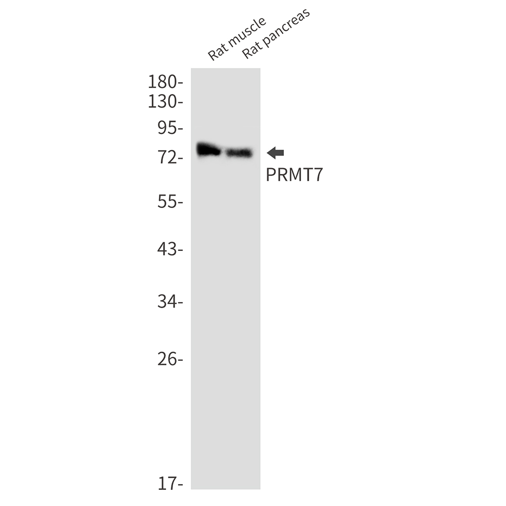 PRMT7