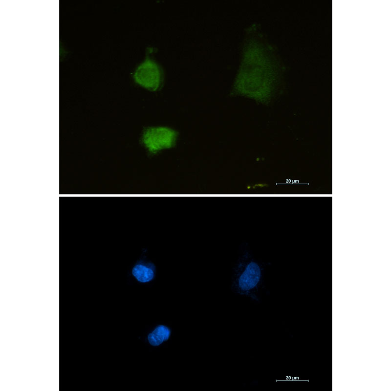 Rabbit Monoclonal Antibody to Proteasome alpha 2