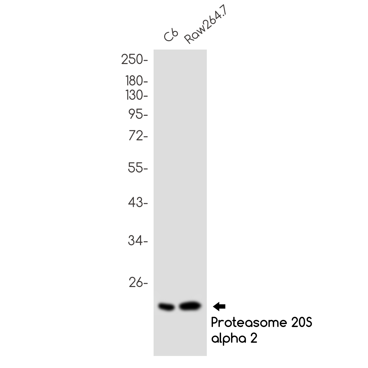 Proteasome beta 9