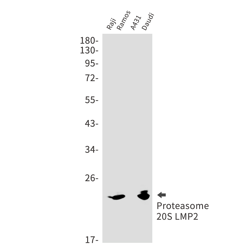 Rabbit Monoclonal Antibody to Proteasome beta 9