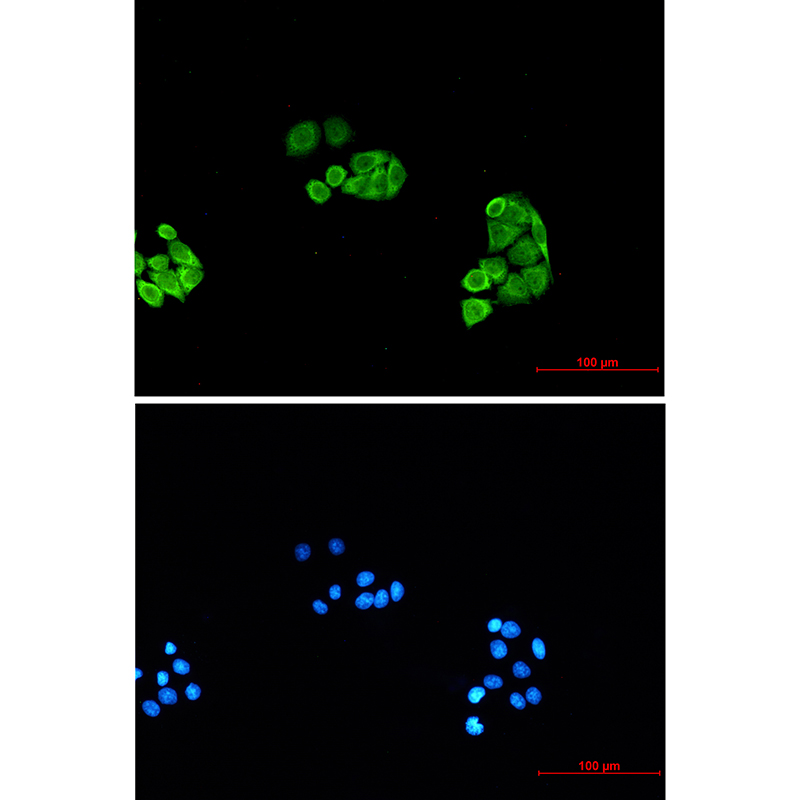 Rabbit Monoclonal Antibody to Proteasome alpha 6