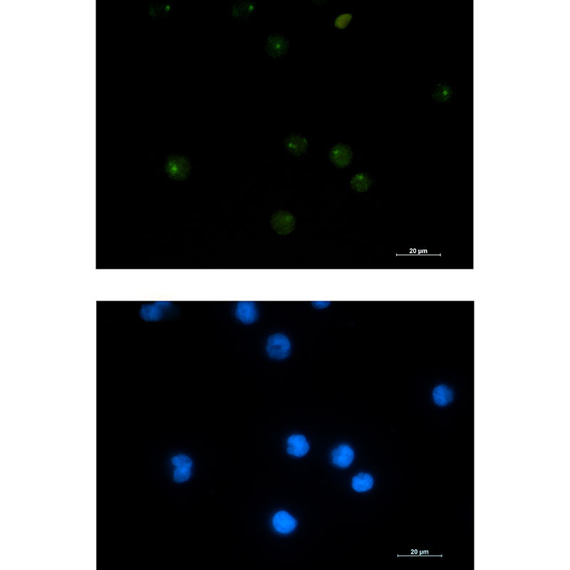 Rabbit Monoclonal Antibody to PSF1