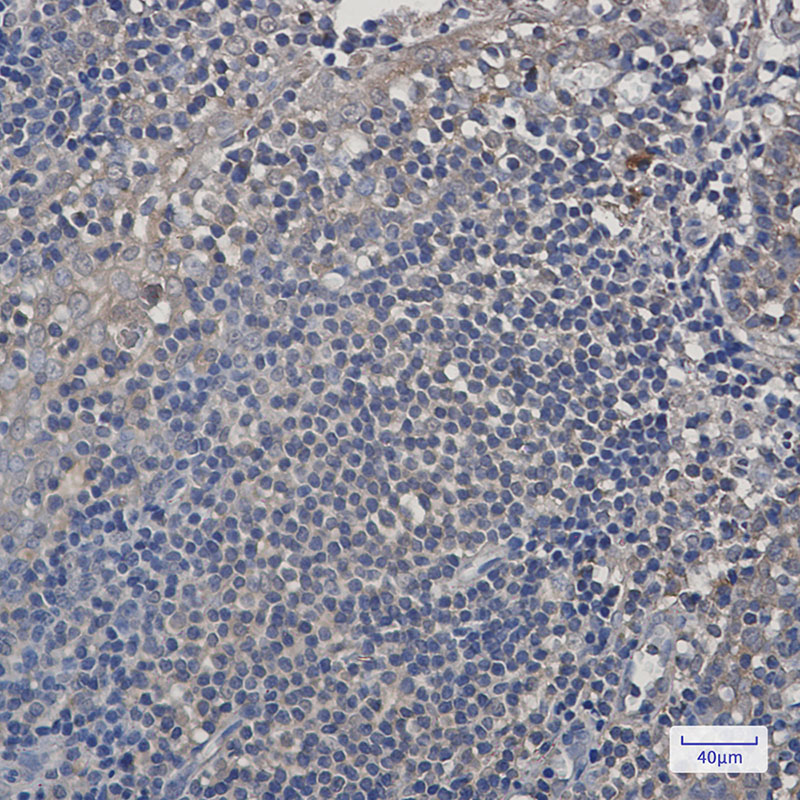 Rabbit Monoclonal Antibody to PSMA4
